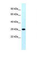 MRPS18B Antibody - MRPS18B antibody Western blot of Jurkat Cell lysate. Antibody concentration 1 ug/ml.  This image was taken for the unconjugated form of this product. Other forms have not been tested.
