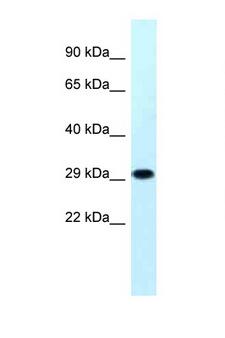 MRPS18B Antibody - MRPS18B antibody Western blot of Jurkat Cell lysate. Antibody concentration 1 ug/ml.  This image was taken for the unconjugated form of this product. Other forms have not been tested.