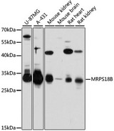 MRPS18B Antibody - Western blot analysis of extracts of various cell lines, using MRPS18B antibody at 1:3000 dilution. The secondary antibody used was an HRP Goat Anti-Rabbit IgG (H+L) at 1:10000 dilution. Lysates were loaded 25ug per lane and 3% nonfat dry milk in TBST was used for blocking. An ECL Kit was used for detection and the exposure time was 30s.