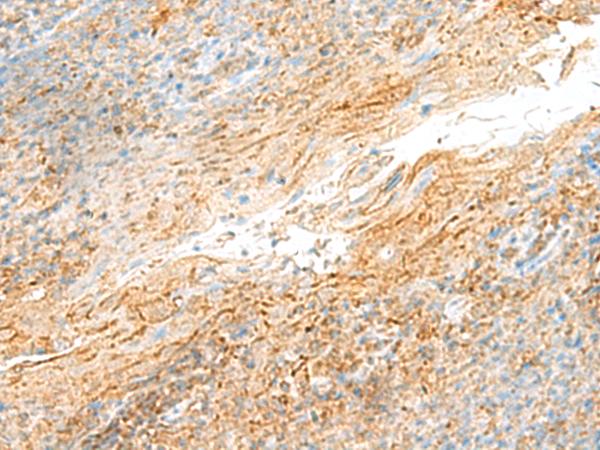 MRPS18B Antibody - Immunohistochemistry of paraffin-embedded Human tonsil tissue  using MRPS18B Polyclonal Antibody at dilution of 1:55(×200)