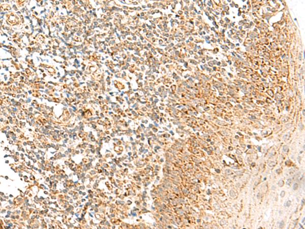 MRPS18B Antibody - Immunohistochemistry of paraffin-embedded Human tonsil tissue  using MRPS18B Polyclonal Antibody at dilution of 1:35(×200)