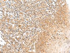MRPS18B Antibody - Immunohistochemistry of paraffin-embedded Human tonsil tissue  using MRPS18B Polyclonal Antibody at dilution of 1:35(×200)