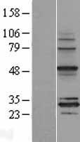MRPS18B Protein - Western validation with an anti-DDK antibody * L: Control HEK293 lysate R: Over-expression lysate