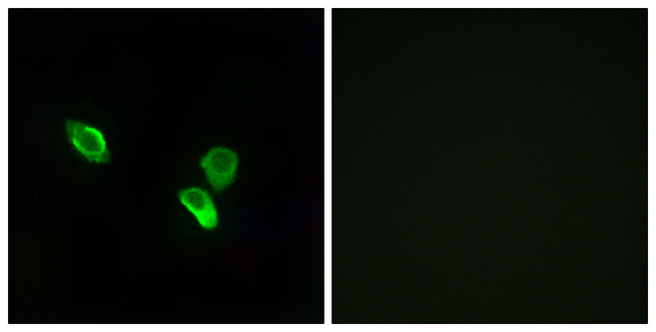 MRPS18C Antibody - Immunofluorescence analysis of MCF7 cells, using MRPS18C Antibody. The picture on the right is blocked with the synthesized peptide.