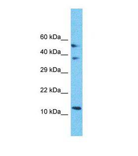 MRPS18C Antibody - Western blot of Human MCF7. MRPS18C antibody dilution 1.0 ug/ml.  This image was taken for the unconjugated form of this product. Other forms have not been tested.