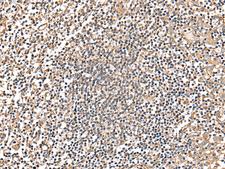 MRPS18C Antibody - Immunohistochemistry of paraffin-embedded Human tonsil tissue  using MRPS18C Polyclonal Antibody at dilution of 1:25(×200)