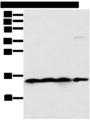 MRPS18C Antibody - Western blot analysis of 231 Hela K562 cell and Human bladder carcinoma tissue  using MRPS18C Polyclonal Antibody at dilution of 1:400