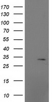 MRPS2 Antibody - HEK293T cells were transfected with the pCMV6-ENTRY control (Left lane) or pCMV6-ENTRY MRPS2 (Right lane) cDNA for 48 hrs and lysed. Equivalent amounts of cell lysates (5 ug per lane) were separated by SDS-PAGE and immunoblotted with anti-MRPS2.