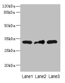 MRPS2 Antibody - Western blot All lanes: MRPS2 antibody at 2.5µg/ml Lane 1: HepG2 whole cell lysate Lane 2: U251 whole cell lysate Lane 3: MCF-7 whole cell lysate Secondary Goat polyclonal to rabbit IgG at 1/10000 dilution Predicted band size: 33 kDa Observed band size: 33 kDa