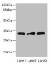 MRPS2 Antibody - Western blot All lanes: MRPS2 antibody at 2.5µg/ml Lane 1: HepG2 whole cell lysate Lane 2: U251 whole cell lysate Lane 3: MCF-7 whole cell lysate Secondary Goat polyclonal to rabbit IgG at 1/10000 dilution Predicted band size: 33 kDa Observed band size: 33 kDa