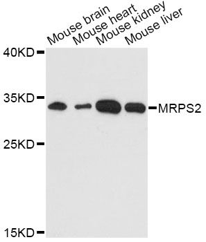 MRPS2 Antibody - Western blot analysis of extracts of various cell lines, using MRPS2 antibody at 1:3000 dilution. The secondary antibody used was an HRP Goat Anti-Rabbit IgG (H+L) at 1:10000 dilution. Lysates were loaded 25ug per lane and 3% nonfat dry milk in TBST was used for blocking. An ECL Kit was used for detection and the exposure time was 90s.