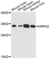 MRPS2 Antibody - Western blot analysis of extracts of various cell lines, using MRPS2 antibody at 1:3000 dilution. The secondary antibody used was an HRP Goat Anti-Rabbit IgG (H+L) at 1:10000 dilution. Lysates were loaded 25ug per lane and 3% nonfat dry milk in TBST was used for blocking. An ECL Kit was used for detection and the exposure time was 90s.
