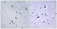 MRPS2 Antibody - Peptide - + Immunohistochemistry analysis of paraffin-embedded human brain tissue, using MRPS2 antibody.