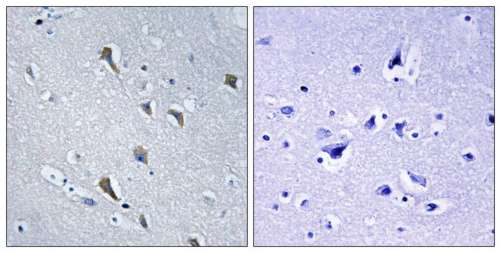 MRPS2 Antibody - Peptide - + Immunohistochemistry analysis of paraffin-embedded human brain tissue, using MRPS2 antibody.