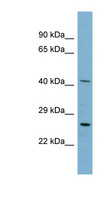 MRPS2 Antibody - MRPS2 antibody Western blot of HepG2 cell lysate. This image was taken for the unconjugated form of this product. Other forms have not been tested.
