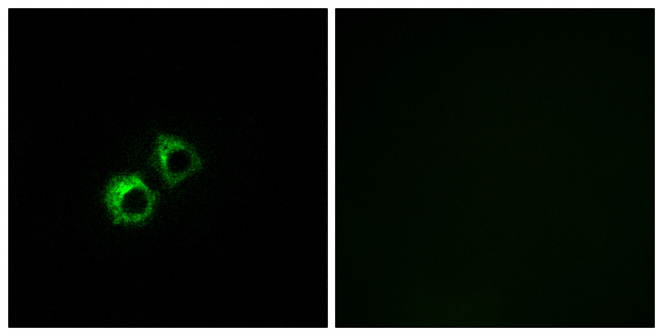 MRPS21 Antibody - Immunofluorescence analysis of MCF7 cells, using MRPS21 Antibody. The picture on the right is blocked with the synthesized peptide.