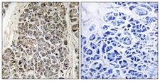 MRPS21 Antibody - Immunohistochemistry analysis of paraffin-embedded human pancreas tissue, using MRPS21 Antibody. The picture on the right is blocked with the synthesized peptide.