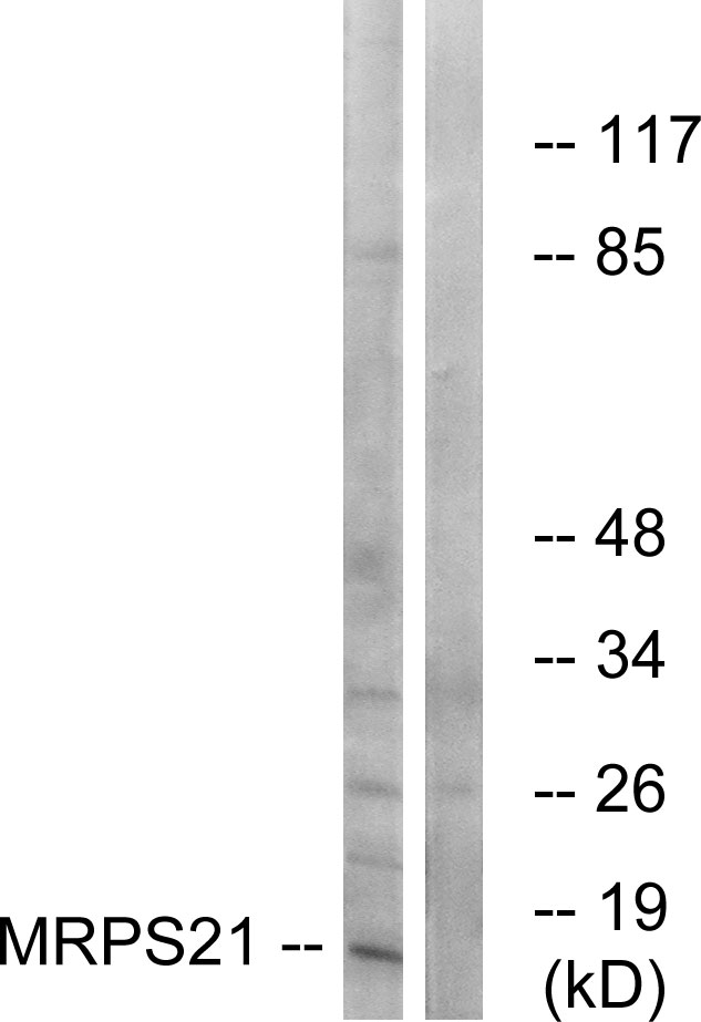 MRPS21 Antibody - Western blot analysis of lysates from COS cells, using MRPS21 Antibody. The lane on the right is blocked with the synthesized peptide.