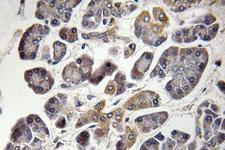 MRPS21 Antibody - IHC of MRP-S21 (Q85) pAb in paraffin-embedded human pancreas tissue.
