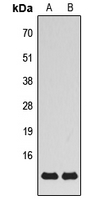 MRPS21 Antibody - Western blot analysis of MRPS21 expression in HeLa (A); mouse brain (B) whole cell lysates.
