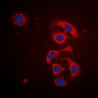 MRPS21 Antibody - Immunofluorescent analysis of MRPS21 staining in HeLa cells. Formalin-fixed cells were permeabilized with 0.1% Triton X-100 in TBS for 5-10 minutes and blocked with 3% BSA-PBS for 30 minutes at room temperature. Cells were probed with the primary antibody in 3% BSA-PBS and incubated overnight at 4 deg C in a humidified chamber. Cells were washed with PBST and incubated with a DyLight 594-conjugated secondary antibody (red) in PBS at room temperature in the dark. DAPI was used to stain the cell nuclei (blue).