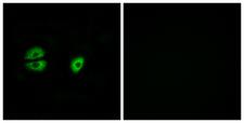 MRPS22 Antibody - Immunofluorescence analysis of A549 cells, using MRPS22 Antibody. The picture on the right is blocked with the synthesized peptide.