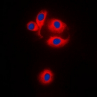MRPS22 Antibody - Immunofluorescent analysis of MRPS22 staining in HEK293T cells. Formalin-fixed cells were permeabilized with 0.1% Triton X-100 in TBS for 5-10 minutes and blocked with 3% BSA-PBS for 30 minutes at room temperature. Cells were probed with the primary antibody in 3% BSA-PBS and incubated overnight at 4 deg C in a humidified chamber. Cells were washed with PBST and incubated with a DyLight 594-conjugated secondary antibody (red) in PBS at room temperature in the dark. DAPI was used to stain the cell nuclei (blue).