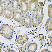 MRPS22 Antibody - Immunohistochemistry of paraffin-embedded human stomach tissue.