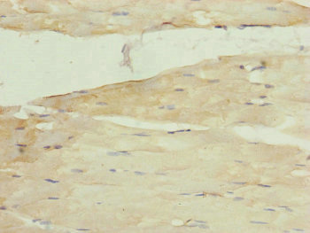 MRPS22 Antibody - Immunohistochemistry of paraffin-embedded human skeletal muscle tissue at dilution of 1:100