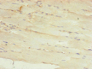 MRPS22 Antibody - Immunohistochemistry of paraffin-embedded human skeletal muscle tissue at dilution of 1:100
