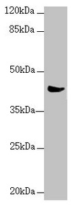 MRPS22 Antibody - Western blot All Lanes:MRPS22 antibody at 2.36 ug/ml+ Mouse liver tissue Secondary Goat polyclonal to rabbit IgG at 1/10000 dilution Predicted band size: 42,19 kDa Observed band size: 41 kDa