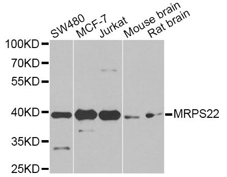 MRPS22 Antibody - Western blot analysis of extracts of various cell lines, using MRPS22 Antibody at 1:1000 dilution. The secondary antibody used was an HRP Goat Anti-Rabbit IgG (H+L) at 1:10000 dilution. Lysates were loaded 25ug per lane and 3% nonfat dry milk in TBST was used for blocking. An ECL Kit was used for detection and the exposure time was 90s.