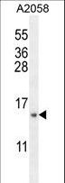 MRPS24 Antibody - MRPS24 Antibody western blot of A2058 cell line lysates (35 ug/lane). The MRPS24 antibody detected the MRPS24 protein (arrow).