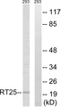 MRPS25 Antibody - Western blot analysis of lysates from 293 cells, using MRPS25 Antibody. The lane on the right is blocked with the synthesized peptide.