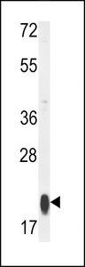 MRPS25 Antibody - Western blot of RT25 Antibody in MCF-7 cell line lysates (35 ug/lane). RT25 (arrow) was detected using the purified antibody.