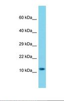 MRPS25 Antibody - Western blot of Human A549. MRPS25 antibody dilution 1.0 ug/ml.  This image was taken for the unconjugated form of this product. Other forms have not been tested.