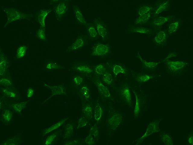MRPS25 Antibody - Immunofluorescence staining of MRPS25 in U2OS cells. Cells were fixed with 4% PFA, permeabilzed with 0.1% Triton X-100 in PBS, blocked with 10% serum, and incubated with rabbit anti-Human MRPS25 polyclonal antibody (dilution ratio 1:200) at 4°C overnight. Then cells were stained with the Alexa Fluor 488-conjugated Goat Anti-rabbit IgG secondary antibody (green). Positive staining was localized to Cytoplasm.