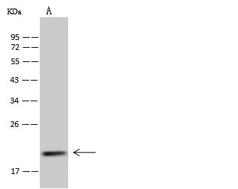 MRPS25 Antibody - Anti-MRPS25 rabbit polyclonal antibody at 1:500 dilution. Lane A: MCF7 Whole Cell Lysate. Lysates/proteins at 30 ug per lane. Secondary: Goat Anti-Rabbit IgG (H+L)/HRP at 1/10000 dilution. Developed using the ECL technique. Performed under reducing conditions. Predicted band size: 20 kDa. Observed band size: 20 kDa.