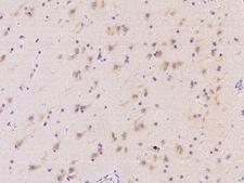 MRPS25 Antibody - Immunochemical staining of human MRPS25 in human brain with rabbit polyclonal antibody at 1:2000 dilution, formalin-fixed paraffin embedded sections.