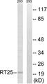 MRPS25 Antibody - Western blot analysis of extracts from 293 cells, using MRPS25 antibody.