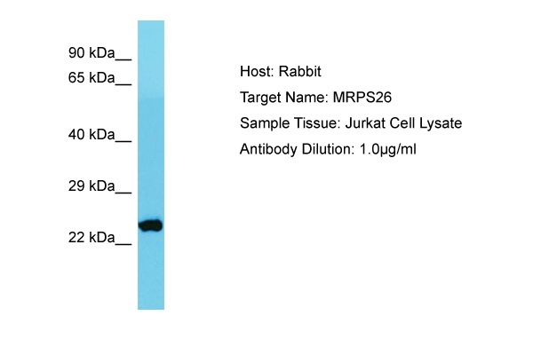 MRPS26 Antibody -  This image was taken for the unconjugated form of this product. Other forms have not been tested.