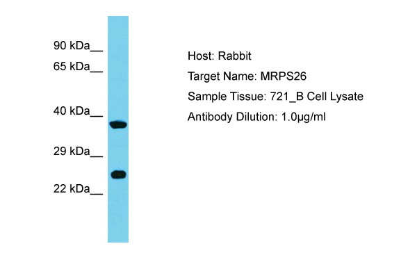 MRPS26 Antibody -  This image was taken for the unconjugated form of this product. Other forms have not been tested.