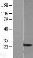 MRPS26 Protein - Western validation with an anti-DDK antibody * L: Control HEK293 lysate R: Over-expression lysate