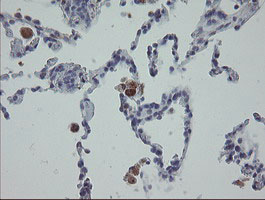 MRPS27 Antibody - IHC of paraffin-embedded Human lung tissue using anti-MRPS27 mouse monoclonal antibody.