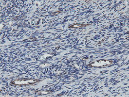 MRPS27 Antibody - IHC of paraffin-embedded Human Ovary tissue using anti-MRPS27 mouse monoclonal antibody.