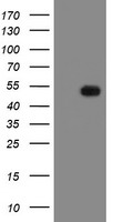 MRPS27 Antibody - HEK293T cells were transfected with the pCMV6-ENTRY control (Left lane) or pCMV6-ENTRY MRPS27 (Right lane) cDNA for 48 hrs and lysed. Equivalent amounts of cell lysates (5 ug per lane) were separated by SDS-PAGE and immunoblotted with anti-MRPS27.