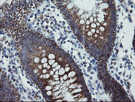 MRPS27 Antibody - IHC of paraffin-embedded Human colon tissue using anti-MRPS27 mouse monoclonal antibody.