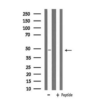 MRPS27 Antibody - Western blot analysis of extracts of HeLa cells using MRPS27 antibody.