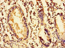 MRPS28 Antibody - Immunohistochemistry of paraffin-embedded human appendix tissue using MRPS28 Antibody at dilution of 1:100