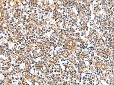 MRPS28 Antibody - Immunohistochemistry of paraffin-embedded Human tonsil tissue  using MRPS28 Polyclonal Antibody at dilution of 1:60(×200)